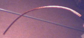 The braid exposed