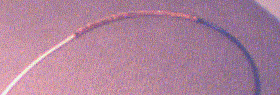 Now the braid is flipped back over the outer insulation